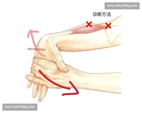 科学运动与康复训练助力网球肘缓解与功能恢复日常护理策略全解析 - 副本